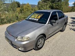 ÖZKAN OTOMOTIVDEN 1998 HUNDAI 1.3 LPG Lİ FULL BAKIMLI