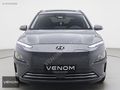 VENOM-2023 Hyundai Kona Progressive-HATASIZ-BOYASIZ-13.000km