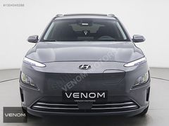 VENOM-2023 Hyundai Kona Progressive-HATASIZ-BOYASIZ-13.000km
