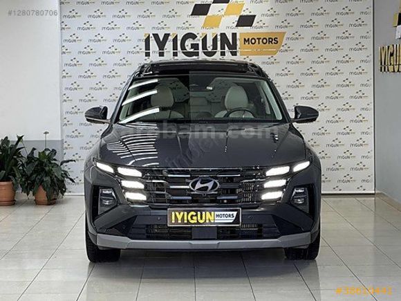 İYİGÜN MOTORS 2025 MODEL ELİT PLUS MAKYAJLI KASA EN FULL PAKET