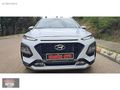 2020 MODEL,ORJİNAL.49,00O KMDE,1,6 CRDI STYLE PAKET.BOYA YOK