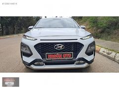 2020 MODEL,ORJİNAL.49,00O KMDE,1,6 CRDI STYLE PAKET.BOYA YOK