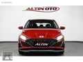 ALTIN OTO DAN %20 FTR KATILIM EVİM FİNANSİLE SATIŞIMIZ MEVCUTTUR