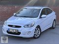 HSN | 2018 HATASIZ OTOMATİK Sağ Kapı Boyalı Kayıtsız 160.km
