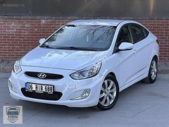 HSN | 2018 HATASIZ OTOMATİK Sağ Kapı Boyalı Kayıtsız 160.km