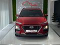 OTTOMOBİLE 2020 HYUNDAI KONA 1.6 CRDI ELITE SMART OTOMATİK..