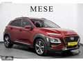 2020 HYUNDAİ KONA 1.6CRDI ELİTE SMART