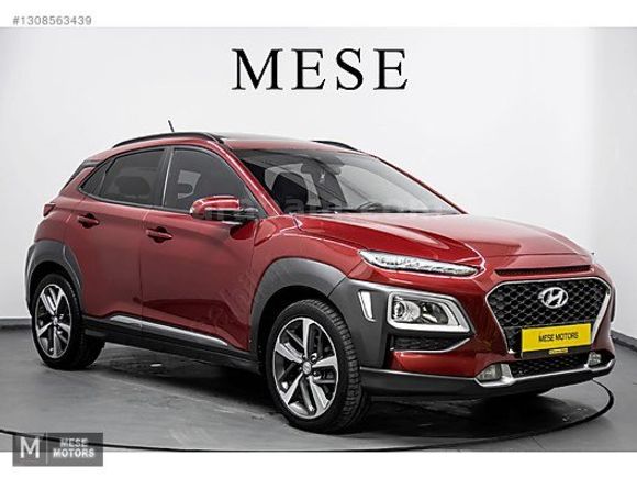 2020 HYUNDAİ KONA 1.6CRDI ELİTE SMART