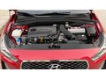 2018 MODEL HYUNDAİ İ30 ELİTE PLUS CAM TAVANLI SERVİS KAYITLI