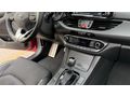 2018 MODEL HYUNDAİ İ30 ELİTE PLUS CAM TAVANLI SERVİS KAYITLI