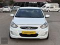 RADAR OTOMOTIV'DEN HATASIZ/BOYASIZ/OTM VİTES
