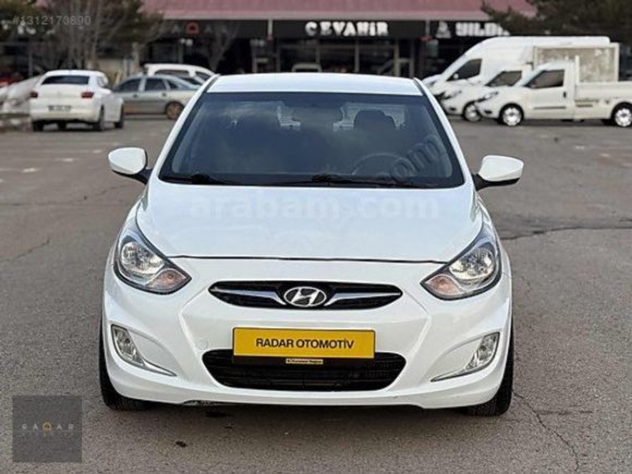 RADAR OTOMOTIV'DEN HATASIZ/BOYASIZ/OTM VİTES