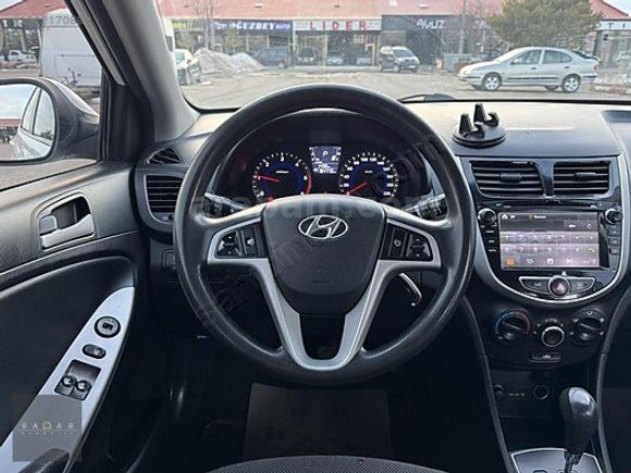 RADAR OTOMOTIV'DEN HATASIZ/BOYASIZ/OTM VİTES