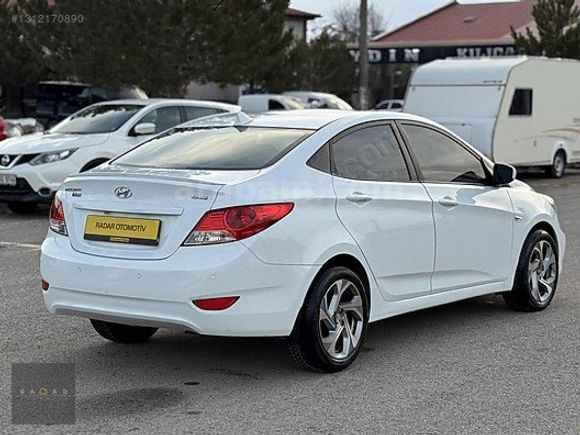 RADAR OTOMOTIV'DEN HATASIZ/BOYASIZ/OTM VİTES