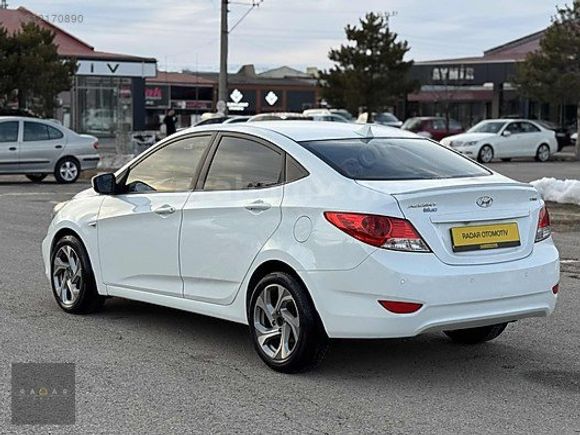 RADAR OTOMOTIV'DEN HATASIZ/BOYASIZ/OTM VİTES