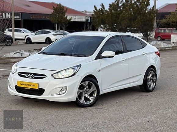 RADAR OTOMOTIV'DEN HATASIZ/BOYASIZ/OTM VİTES