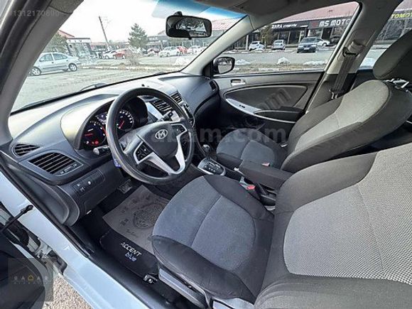RADAR OTOMOTIV'DEN HATASIZ/BOYASIZ/OTM VİTES