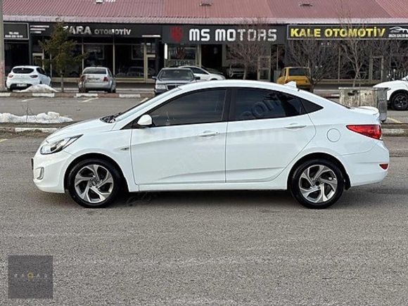 RADAR OTOMOTIV'DEN HATASIZ/BOYASIZ/OTM VİTES