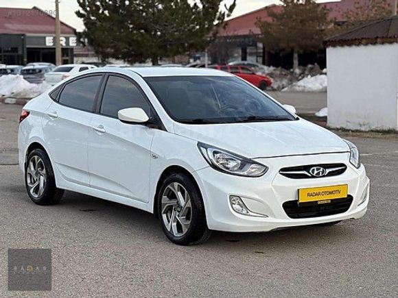 RADAR OTOMOTIV'DEN HATASIZ/BOYASIZ/OTM VİTES