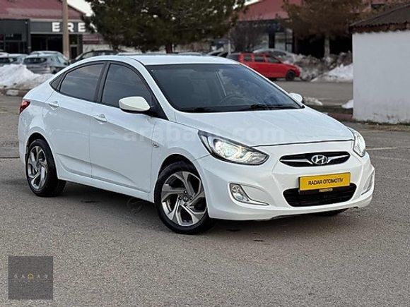 RADAR OTOMOTIV'DEN HATASIZ/BOYASIZ/OTM VİTES