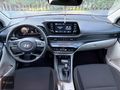 2023 MODEL 31 BİNDE MAKYAJLI KASA OTOMATİK 1.4 ELİTE