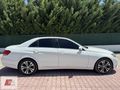 RS GARAGE'DAN HATASIZ AYARINDA E250 CDİ 4MATIC