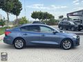 2024 FOCUS 1.5 ECOBLUE 37.ooo KM TİTANYUM STİL