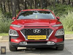 FURKAN BAYRAMOĞLU/HYUNDAİ KONA 1.6 CRDI/ ELİT SMART