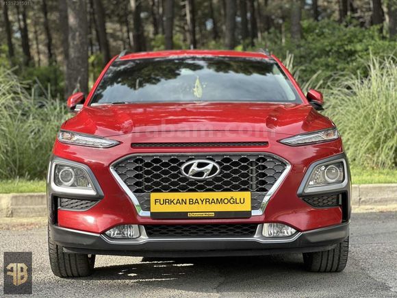 FURKAN BAYRAMOĞLU/HYUNDAİ KONA 1.6 CRDI/ ELİT SMART