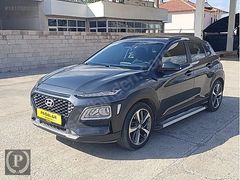 2020 MODEL/BOYASIZ/OTOMATİK/130 BİN KM/SMART PAKET/KONA