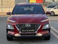 2020 -KONA- ELİTE SMART- 84 BİN KM -TAKAS -TAKSİT OLUR