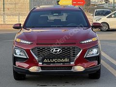 2020 -KONA- ELİTE SMART- 84 BİN KM -TAKAS -TAKSİT OLUR