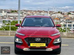 MY CAR OTOMOTİV'DEN KONA STYLE 136HP HATASIZ OTOMATİK DİZEL