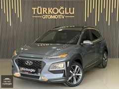 TÜRKOĞLUOTOMOTİV~KONA~1.6CRDİ~ELİTESMART~18.XXXKM~SANROFF