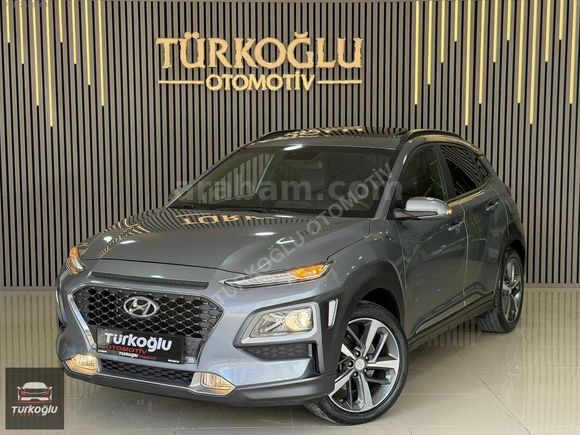 TÜRKOĞLUOTOMOTİV~KONA~1.6CRDİ~ELİTESMART~18.XXXKM~SANROFF