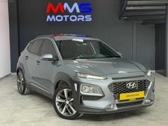 MMS MOTORS'DAN 2020 KONA 1.6 CRDI ELİTE SMART SRF DCT SUNROF