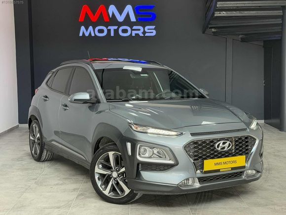 MMS MOTORS'DAN 2020 KONA 1.6 CRDI ELİTE SMART SRF DCT SUNROF
