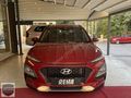 2020 HYUNDAI KONA 1.6CRDI SMART SUNROOF+BOYASIZ+HATASIZ
