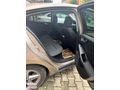 HATASIZ AYARINDA 100 BİN KM