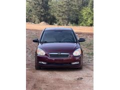 HATASIZ AYARINDA 210 BİN KM DE