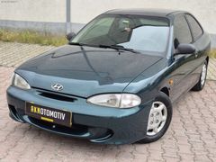 AKN OTOMOTIVDEN MASRAFSIZ SORUNSUZ HYUNDAİ CUPE