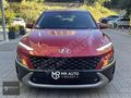 MR AUTO'DAN 2022 HYUNDAI KONA 1.0TGDI DCT STYLE HATASIZ -BOYASIZ