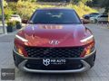 MR AUTO'DAN 2022 HYUNDAI KONA 1.0TGDI DCT STYLE HATASIZ -BOYASIZ