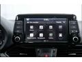 Sahibinden Hyundai i30 1.6 CRDi Elite Plus 2017 Model 