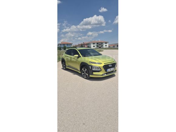 Sahibinden Hyundai Kona servis bakımlı