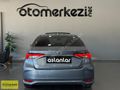 2025 TOYOTA COROLLA 1.5 FLAME X-PACK / HATASIZ + BOYASIZ