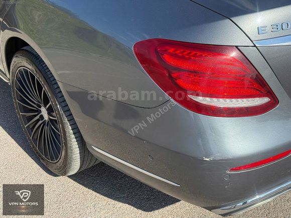 2017 MERCEDES E 300 | 178000KM | DEĞİŞENSİZ