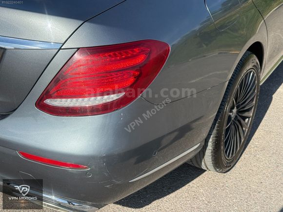 2017 MERCEDES E 300 | 178000KM | DEĞİŞENSİZ