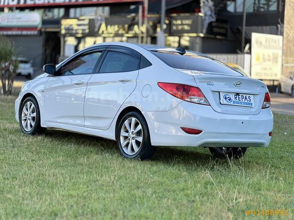 (FULL PAKET)2017 ACCENT BLUE HATASIZ AYARINDA