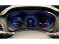 2017 RENAULT MEGANE 1.6 BENZİN LPG MANUEL DEĞİŞENSİZ 122KM